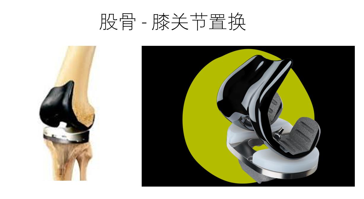 CYB025-40Z-2G耐酸膠遮蔽提升骨科植入物制造效率與表面處理精度